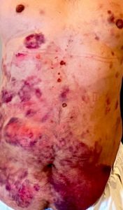 2020_12.8.14ブログ用画像_200814